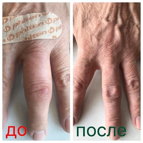 Тейпы Phiten Titanium Aid X30 – 20 шт, влагостойкие. Купить!